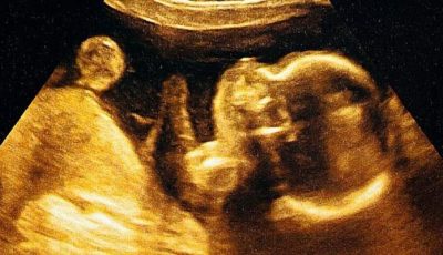 وداعا لقاعدة «نايجل».. الذكاء الاصطناعي يتوقع يوم الولادة بدقة 95%