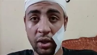 سائق شركة توصيل يستغيث من زميله بالعجوزة: اتخانق معايا على زبون وأصابني بـ80 غرزة